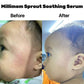 Millimom Sprout Soothing Serum